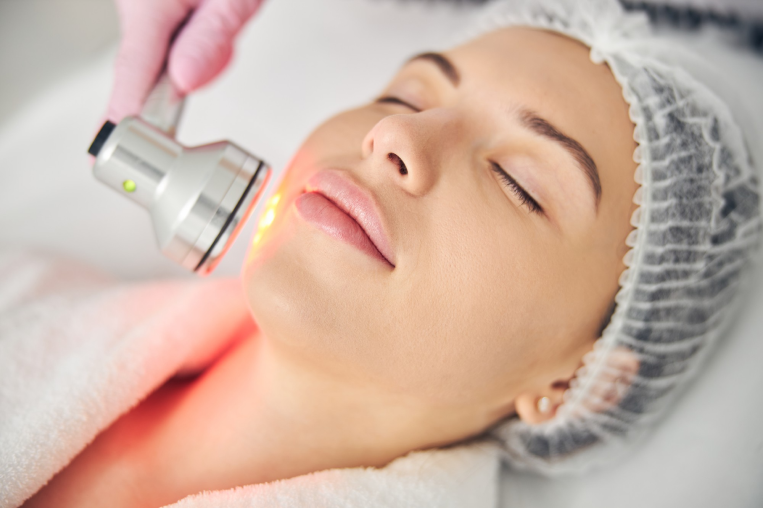 Fractional CO2 Laser for Large Pores and Uneven Texture